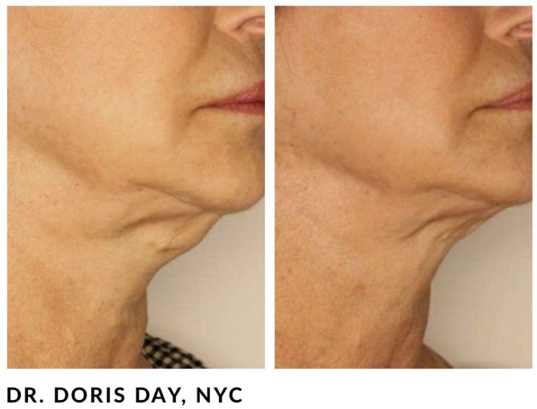 Eurothreads - Hamilton Dermatology